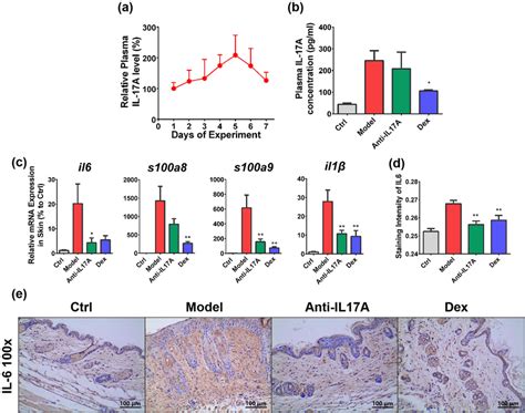 Involvement Of Il17a Signaling In Disease Progression A Plasma Il17a Download Scientific