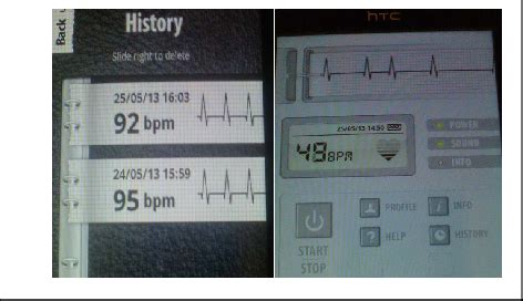 Cardiograph and history VII. COMMUNICATION PROTOCOL | Download ...