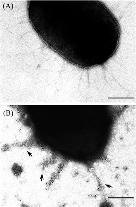 Transmission Electron Micrographs Of Double Immunogold Labeling P