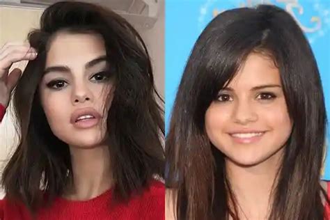 Selena Gomez Plastic Surgery Rumors And Details