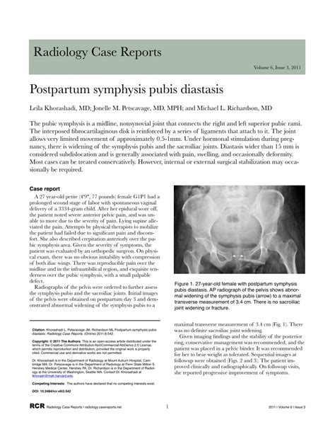 Pdf Postpartum Symphysis Pubis Diastasis