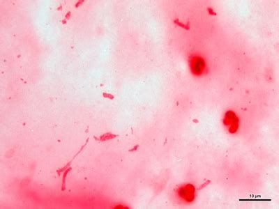 Klebsiella Gram Stain