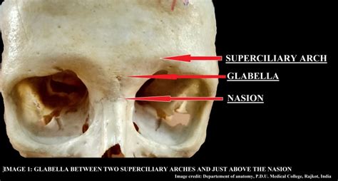 Anatomy Head And Neck Glabella Statpearls Ncbi Bookshelf