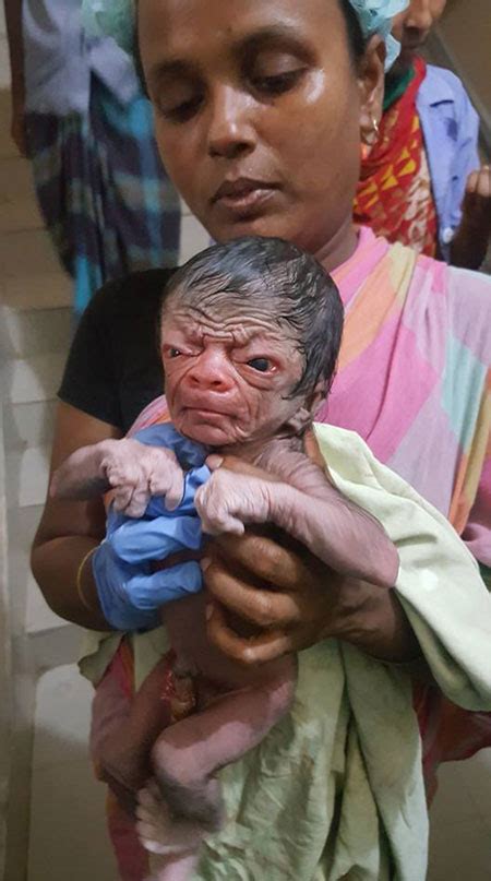 Baby With Old Look Born In Magura Countryside