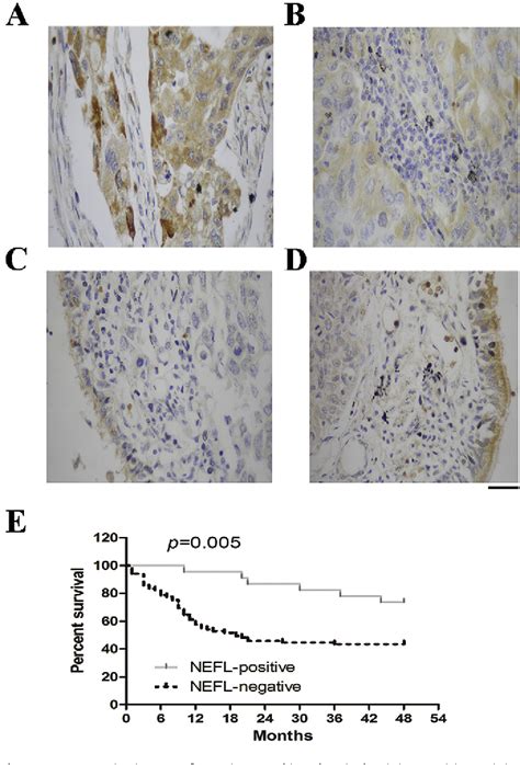 Figure 1 From Methylation Of Neurofilament Light Polypeptide Promoter