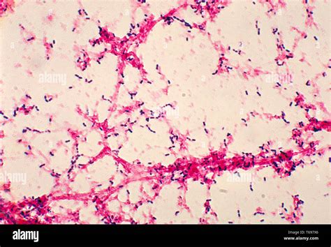 Streptococcus Pneumoniae Fotograf As E Im Genes De Alta Resoluci N Alamy