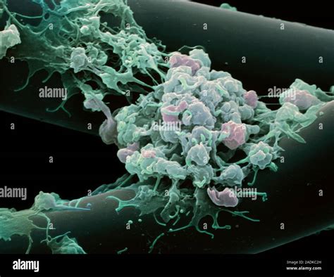 Activated Platelets Coloured Scanning Electron Micrograph Sem Of