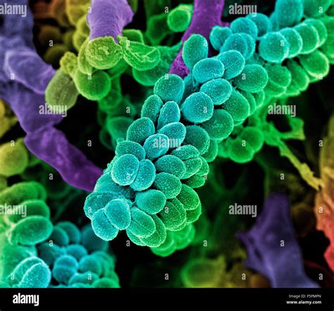 Streptococcus Pneumoniae Or Pneumococcus Is Gram Positive Coccus