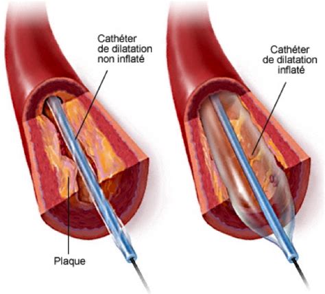 Le déroulement de l examen Cardio paramed Cardio paramed