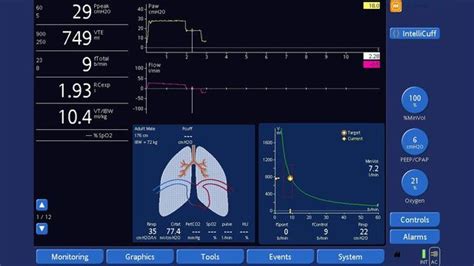 29+ plateau pressure calculation - HiyaSarena