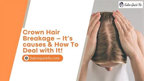 Crown Hair Breakage It S Causes How To Deal With It Salonquickfix