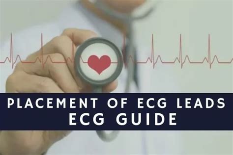 Placement of Ecg leads : ECG Guide