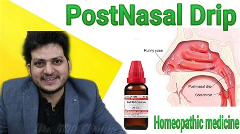 Homeopathic Medicine For Postnasal Drip Sinusitis Rhinitis Throat Infection Youtube