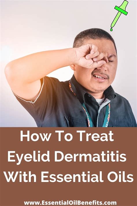 Eyelid dermatitis – Artofit