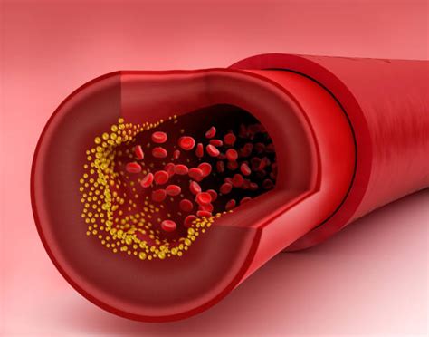 Prosthetic Vascular Graft Technology Research