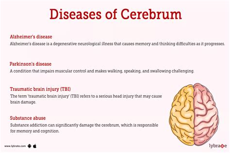 Cerebrum Human Anatomy Image Functions Diseases And Treatments