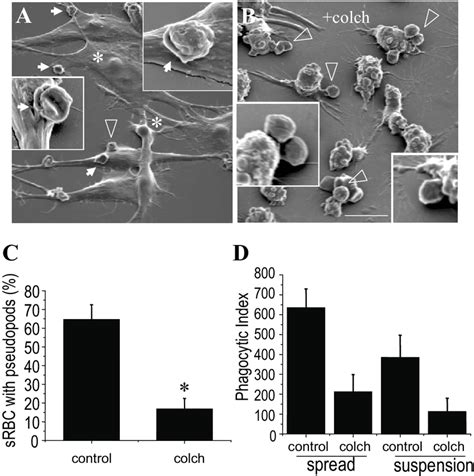 Colchicine decreases pseudopod formation and extension in macrophages... | Download Scientific ...