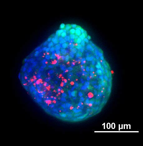 Advances In Cancer Research Imaging Of 3D Tumor Spheroids