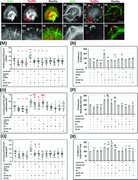 Cofilin Suppression Enhances Tnbc Cell Adhesion While Androgen