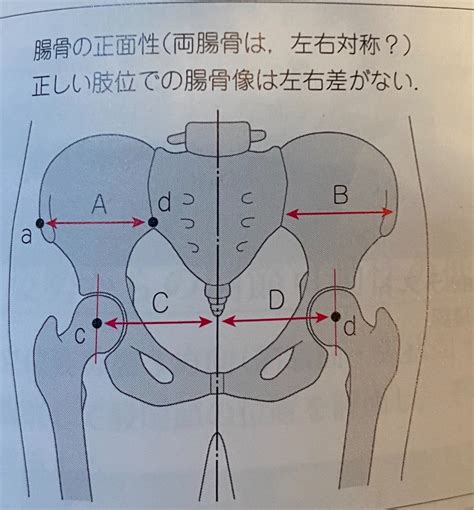 身体の使い方seriesその55『腸骨を合わせる』骨盤の調整方の一つです。クライマー・武術家・一般の方々にもオススメです‼︎ Chiryouin111’s Diary