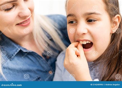 A Loose Baby Tooth Falls Out In A Little Girl With An Open Mouth Stock