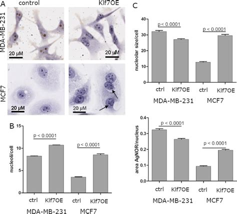 Aberrant Nucleoli Morphology In Vitro A Representative Images Of Agnor