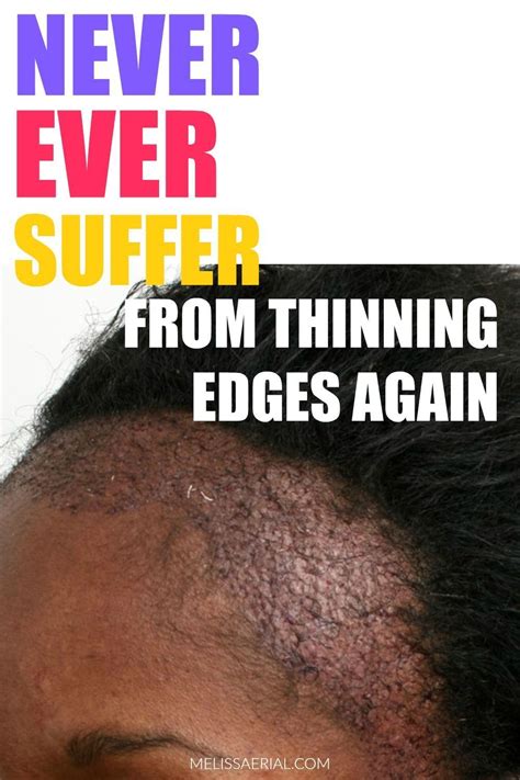 Get Practical Tips To Regrow Your Thinning Edges Fast Thinning Edges