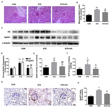 Effects Of Ag On Fn And Sphk S P Signaling Pathway In Stz Induced