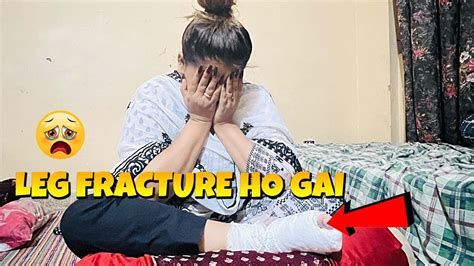 MERI LEG FRACTURE HO GAI YouTube