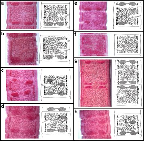 Microphotographs And Schematic Illustrations Of Morphology Of The Download Scientific Diagram