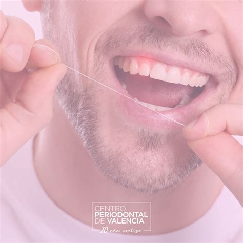 Estrategias Efectivas Para Prevenir La Periodontitis Centro