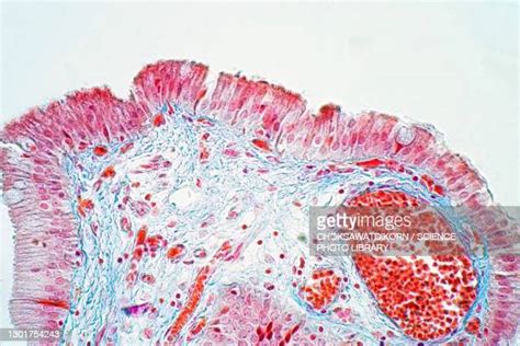 107 Simple Columnar Epithelium Stock Photos High Res Pictures And