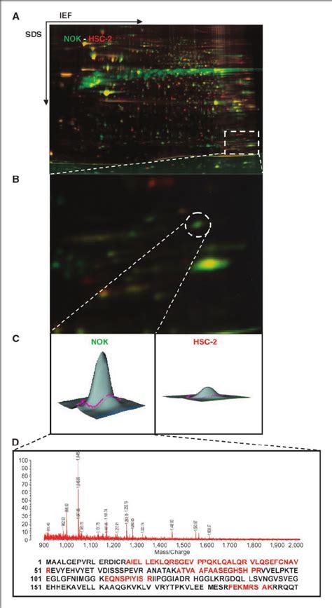 Comparative Analysis Of Oscc Derived Cells And Noks Using The 2d Dige Download Scientific