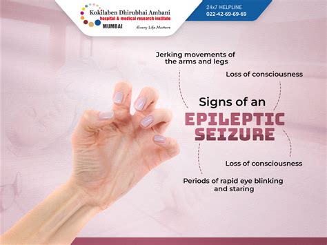 Signs of an epileptic seizure - National Epilepsy Day