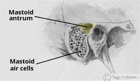 Niebla T Xica Separaci N Agotar Mastoid Cavity Anatomy Lluvia Impuesto