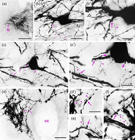 Immunoperoxidase Localization Of Yellow Fluorescent Protein Yfp