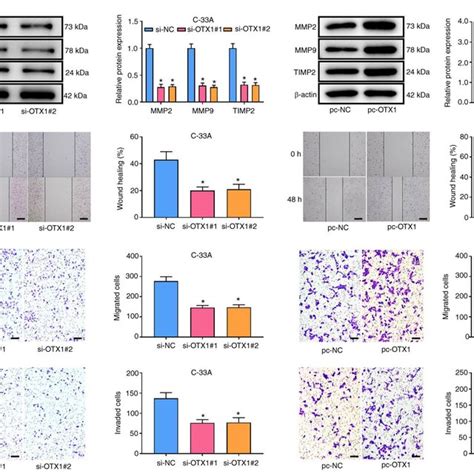 Otx1 Increases Migration And Invasion Of Cervical Cancer Cells A Download Scientific Diagram