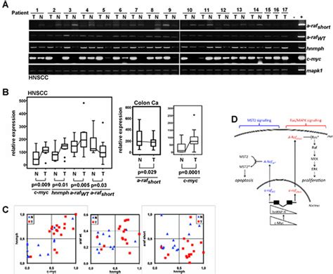 Expression Of C Myc HnRNP H And A Raf Isoforms In Carcinomas And