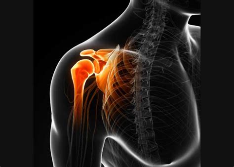 Rotator Cuff Injury Orthopedic Shoulder Specialist Vail Aspen