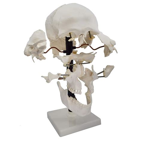 Exploded Skull Model 22 Parts - Life Sizeskull - Ravi Scientific Industries