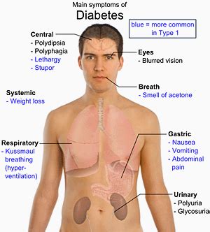 Nursing Care Plan For Diabetes Mellitus Nursing Care Plan