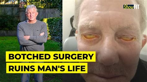 79 Year Old Man Unable To Shut His Eye For Nearly Three Years After