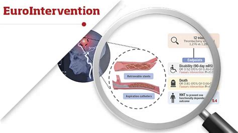 Thrombectomy