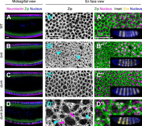 Early Zygotic Gene Product Dunk Interacts With Anillin To Regulate