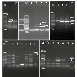 Agarose Gel Stained With Ethidium Bromide Showing Pcr Product Of