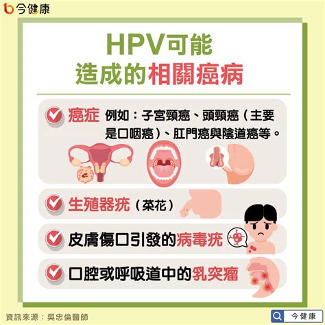 少數能預防癌症的疫苗！男女接種hpv疫苗助遠離頭頸癌與子宮頸癌 今健康