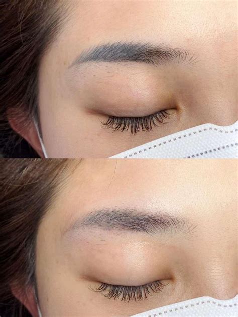 Frequently Asked Questions About Eyebrow Tattoo Removal — Singapore