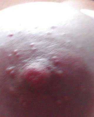 Tied Tits Porn Pics Pictoa