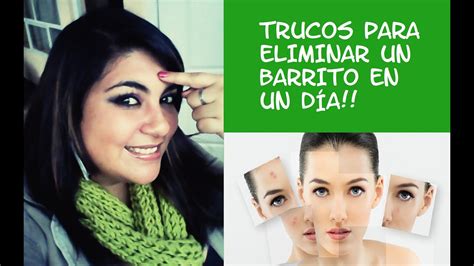 Trucos Para Eliminar Un Barrito En Un Día YouTube