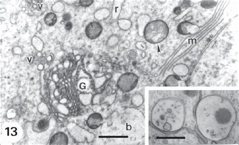 Area Of The Oocyte In A Secondary Follicle With Multivesicular Bodies